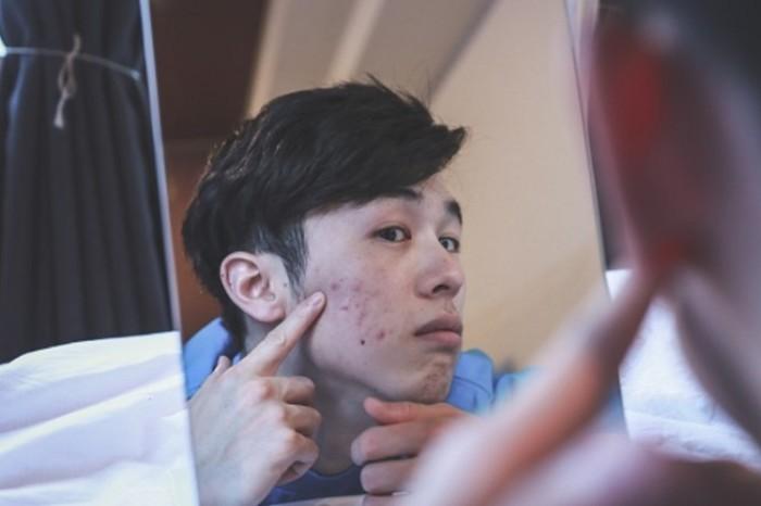 Dansen met acne: Tips voor meer zelfvertrouwen 3 word image 26500 3